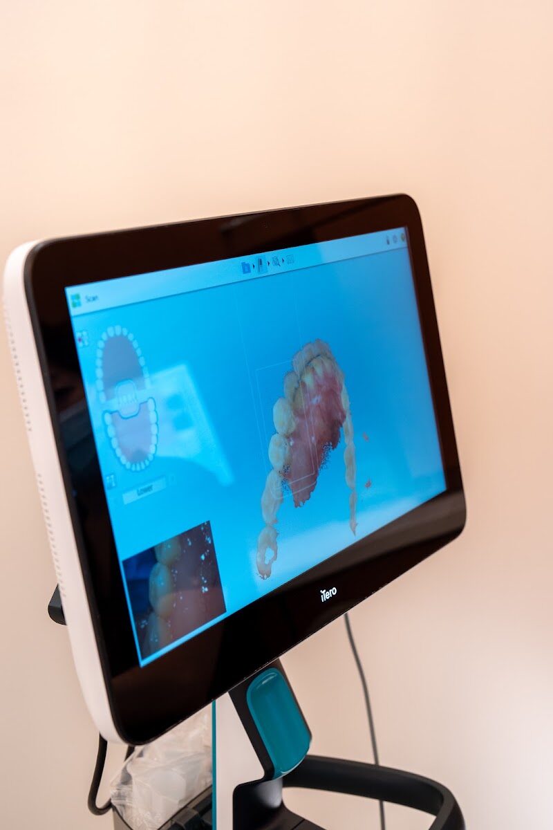 Digital 3D scan of a patient's teeth
